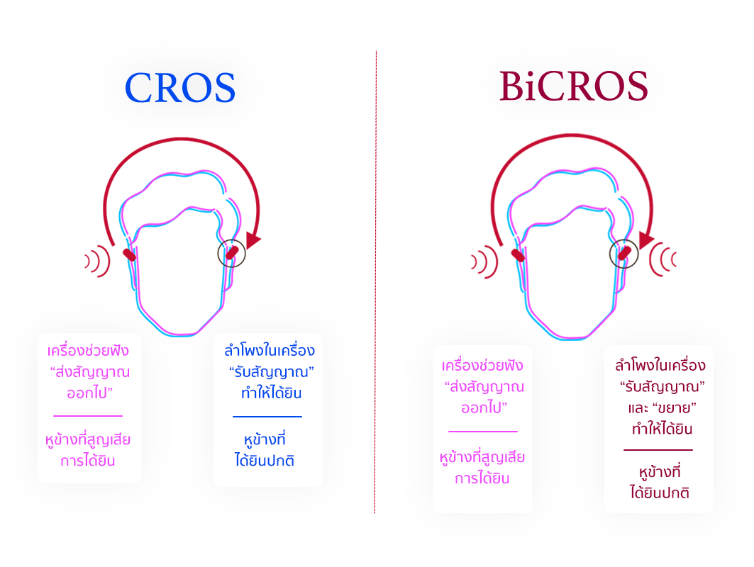 CROS Vs BiCROS แตกต่างกันอย่างไร เครื่องช่วยฟัง แบบไหนเหมาะกับเรา ...