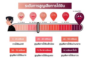 ระดับการได้ยิน